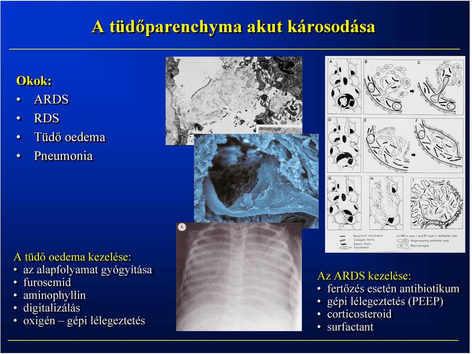 aminophyllin digitalizálás oxigén gépi lélegeztetés Az ARDS kezelése: