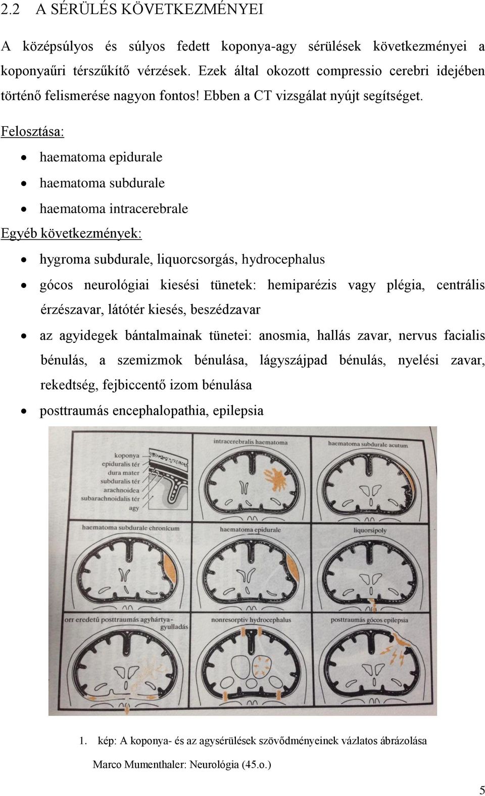 Felosztása: haematoma epidurale haematoma subdurale haematoma intracerebrale Egyéb következmények: hygroma subdurale, liquorcsorgás, hydrocephalus gócos neurológiai kiesési tünetek: hemiparézis vagy