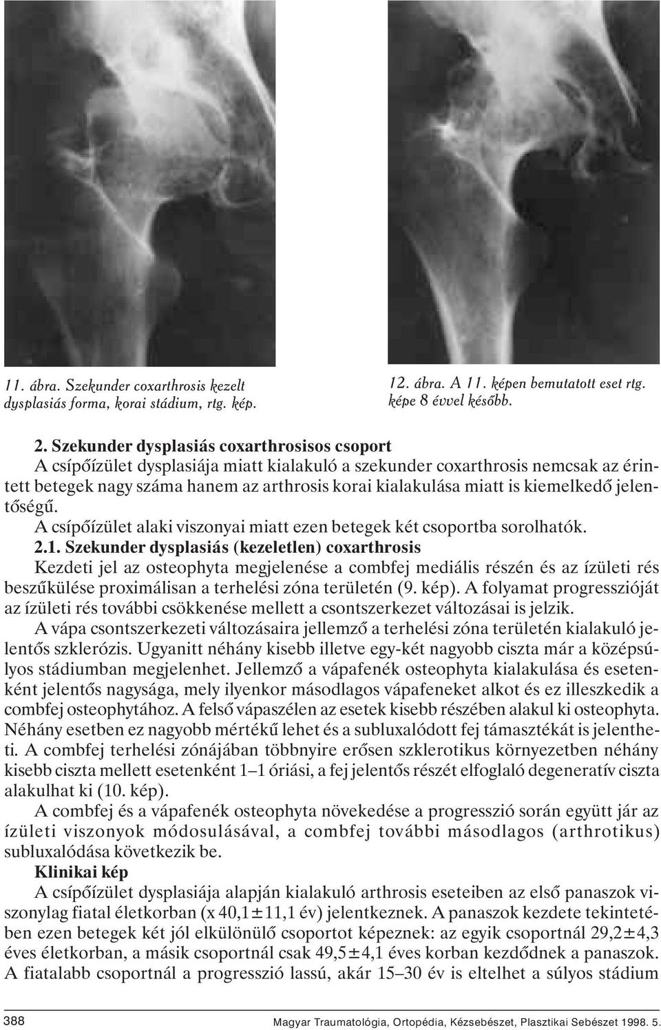 kiemelkedô jelentôségû. A csípôízület alaki viszonyai miatt ezen betegek két csoportba sorolhatók. 2.1.