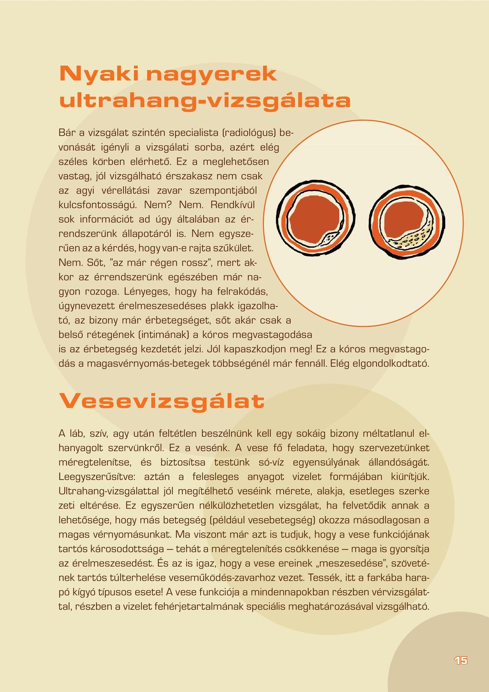 Nem egyszerûen az a kérdés, hogy van-e rajta szûkület. Nem. Sôt, az már régen rossz, mert akkor az érrendszerünk egészében már nagyon rozoga.