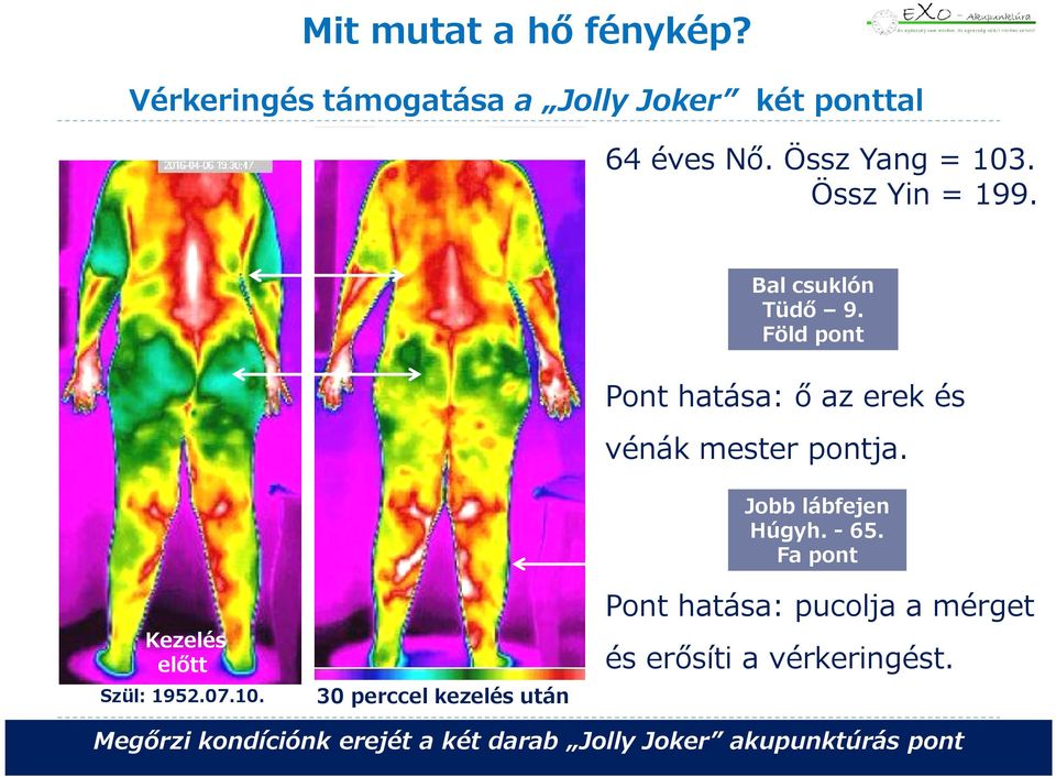 Föld pont Pont hatása: ő az erek és vénák mester pontja. Jobb lábfejen Húgyh. - 65.