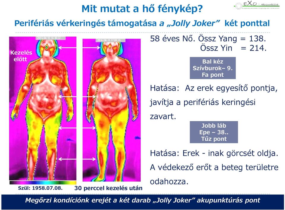 Össz Yang = 138. Össz Yin = 214. Bal kéz Szívburok 9. Fa pont Szül: 1958.07.08.