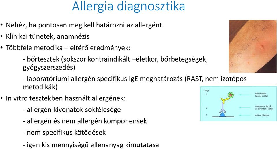allergén specifikus IgE meghatározás (RAST, nem izotópos metodikák) In vitro tesztekben használt allergének: - allergén