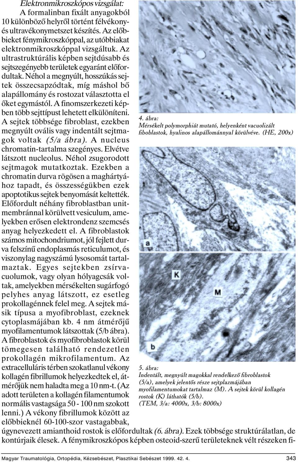 Néhol a megnyúlt, hosszúkás sejtek összecsapzódtak, míg máshol bõ alapállomány és rostozat választotta el õket egymástól. A finomszerkezeti képben több sejttípust lehetett elkülöníteni.