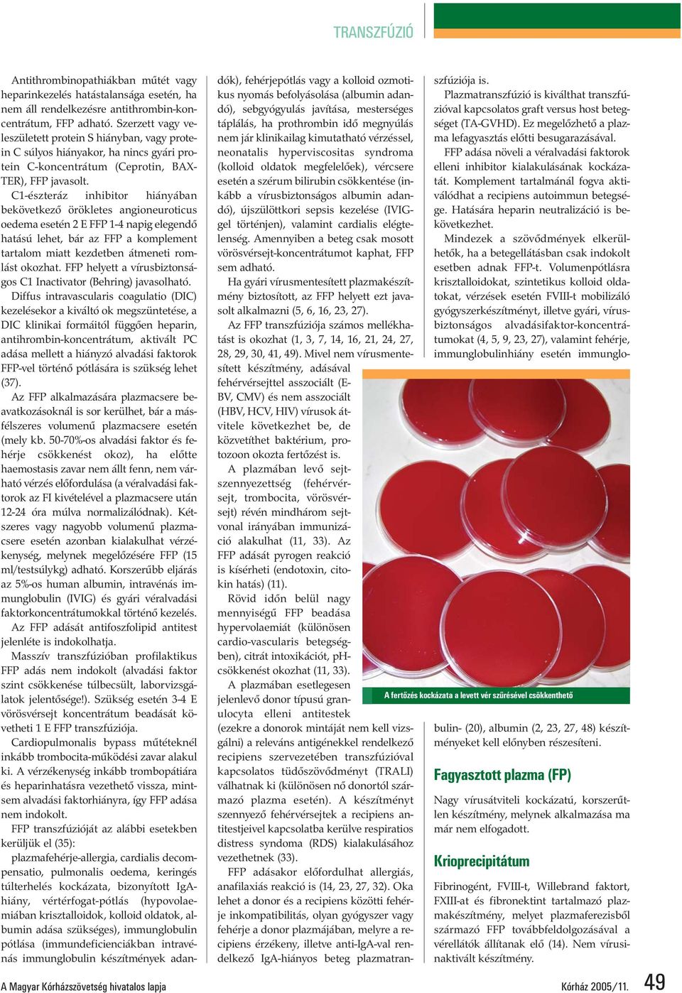 C1-észteráz inhibitor hiányában bekövetkező örökletes angioneuroticus oedema esetén 2 E FFP 1-4 napig elegendő hatású lehet, bár az FFP a komplement tartalom miatt kezdetben átmeneti romlást okozhat.