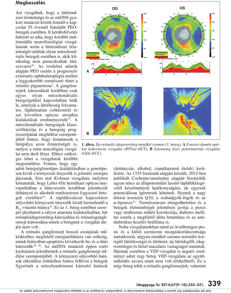 panaszkodtak látászavarra 16. Az irodalmi adatok alapján PEO esetén a progresszív externalis ophthalmoplegia mellett a leggyakoribb szemészeti tünet a retinitis pigmentosa 3.