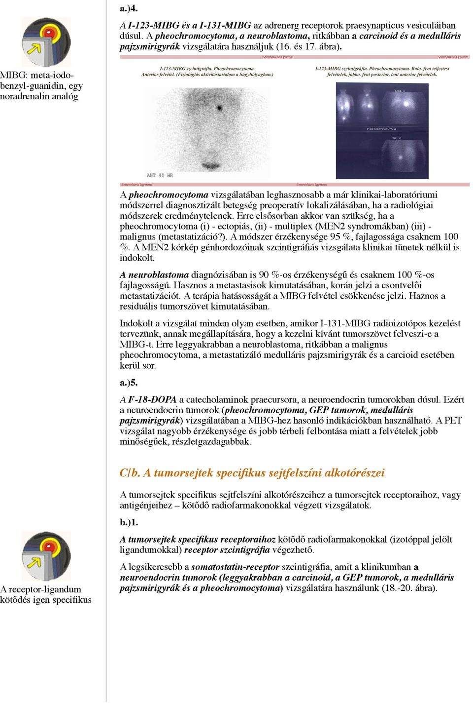 MIBG: meta-iodobenzyl-guanidin, egy noradrenalin analóg A pheochromocytoma vizsgálatában leghasznosabb a már klinikai-laboratóriumi módszerrel diagnosztizált betegség preoperatív lokalizálásában, ha