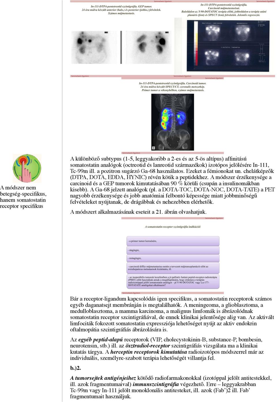 A módszer érzékenysége a carcinoid és a GEP tumorok kimutatásában 90 % körüli (csupán a insulinomákban kisebb). A Ga-68 jelzett analógok (pl.