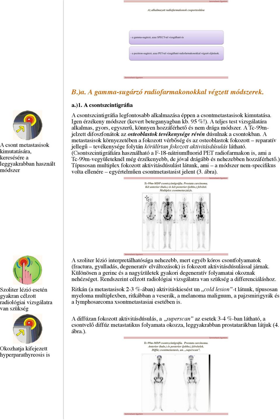 A teljes test vizsgálatára alkalmas, gyors, egyszerű, könnyen hozzáférhető és nem drága módszer. A Tc-99mjelzett difoszfonátok az osteoblastok tevékenysége révén dúsulnak a csontokban.