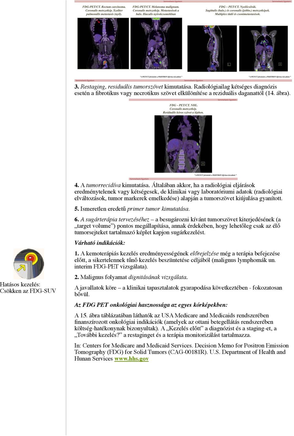 Általában akkor, ha a radiológiai eljárások eredménytelenek vagy kétségesek, de klinikai vagy laboratóriumi adatok (radiológiai elváltozások, tumor markerek emelkedése) alapján a tumorszövet