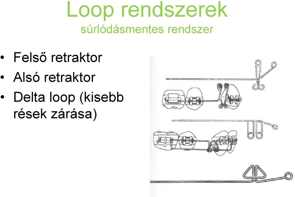 (kisebb rések zárása)