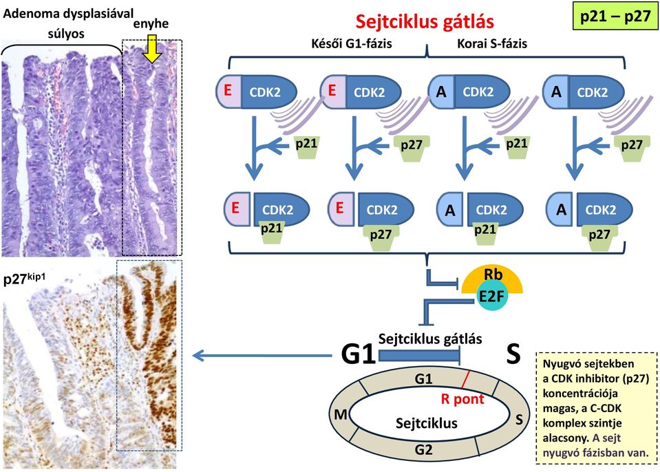 kip1 Rb E2F G1 M Sejtciklus gátlás G1 R pont Sejtciklus G2 S S Nyugvó sejtekben a CDK