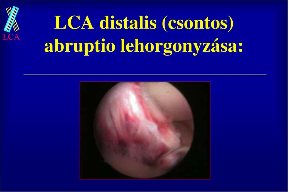 (csontos)