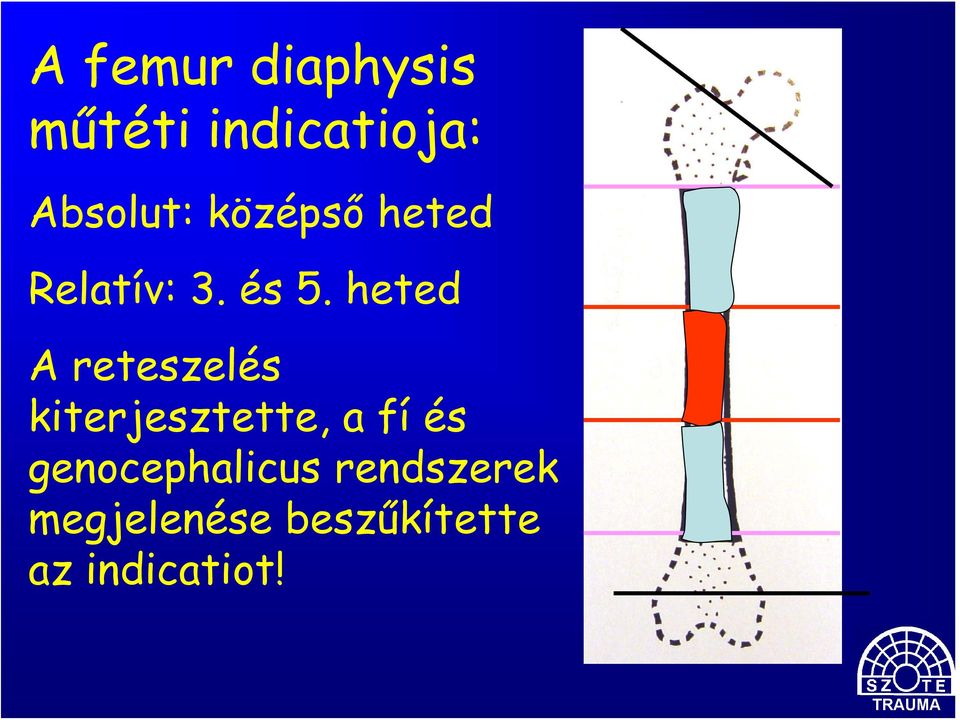 heted A reteszelés kiterjesztette, a fí és