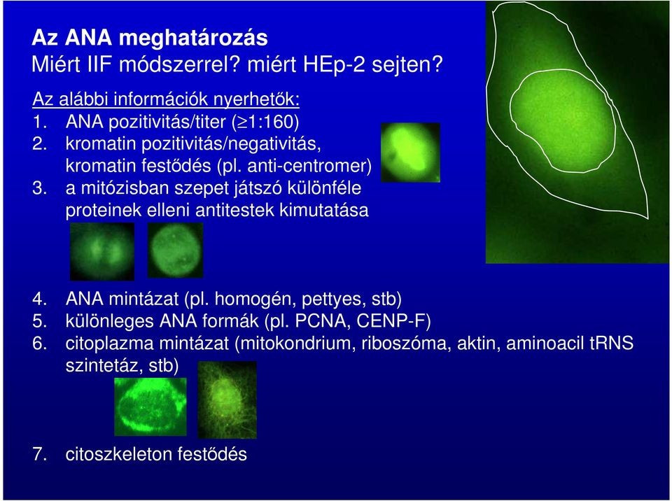 a mitózisban szepet játszó különféle proteinek elleni antitestek kimutatása 4. ANA mintázat (pl.