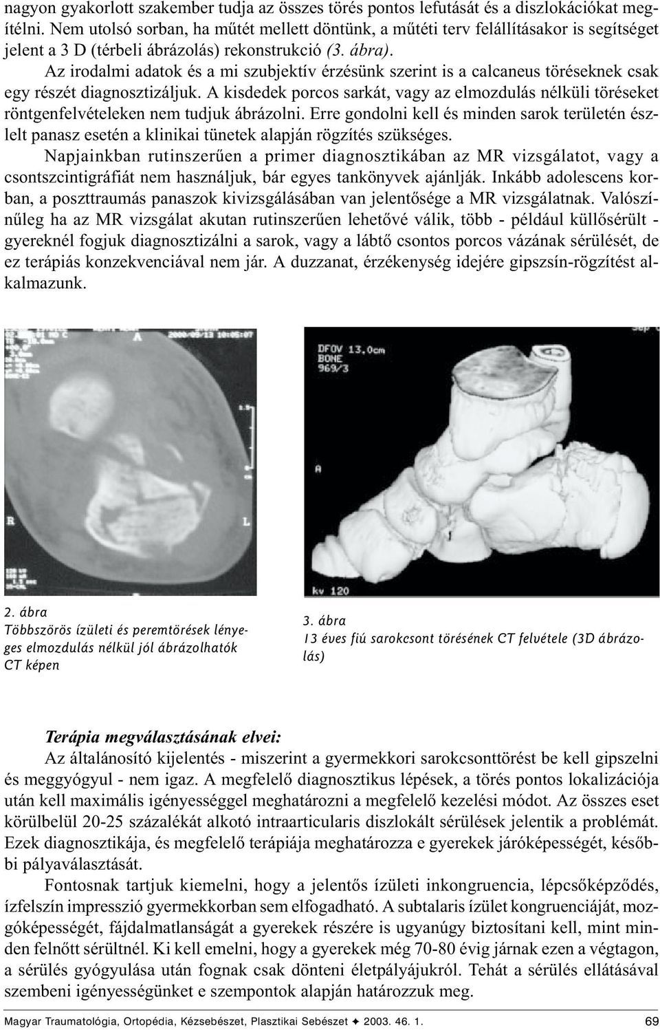 Az irodalmi adatok és a mi szubjektív érzésünk szerint is a calcaneus töréseknek csak egy részét diagnosztizáljuk.