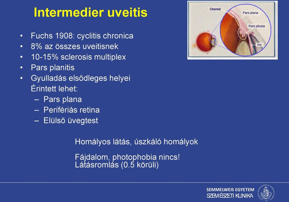 helyei Érintett lehet: Pars plana Perifériás retina Elülső üvegtest