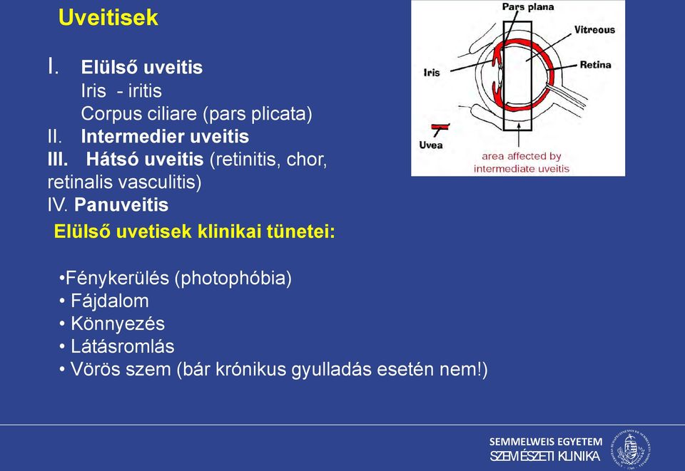 Hátsó uveitis (retinitis, chor, retinalis vasculitis) IV.