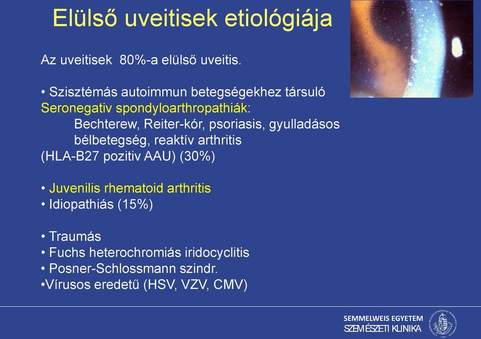 Reiter-kór, psoriasis, gyulladásos bélbetegség, reaktív arthritis (HLA-B27 pozitiv AAU) (30%)
