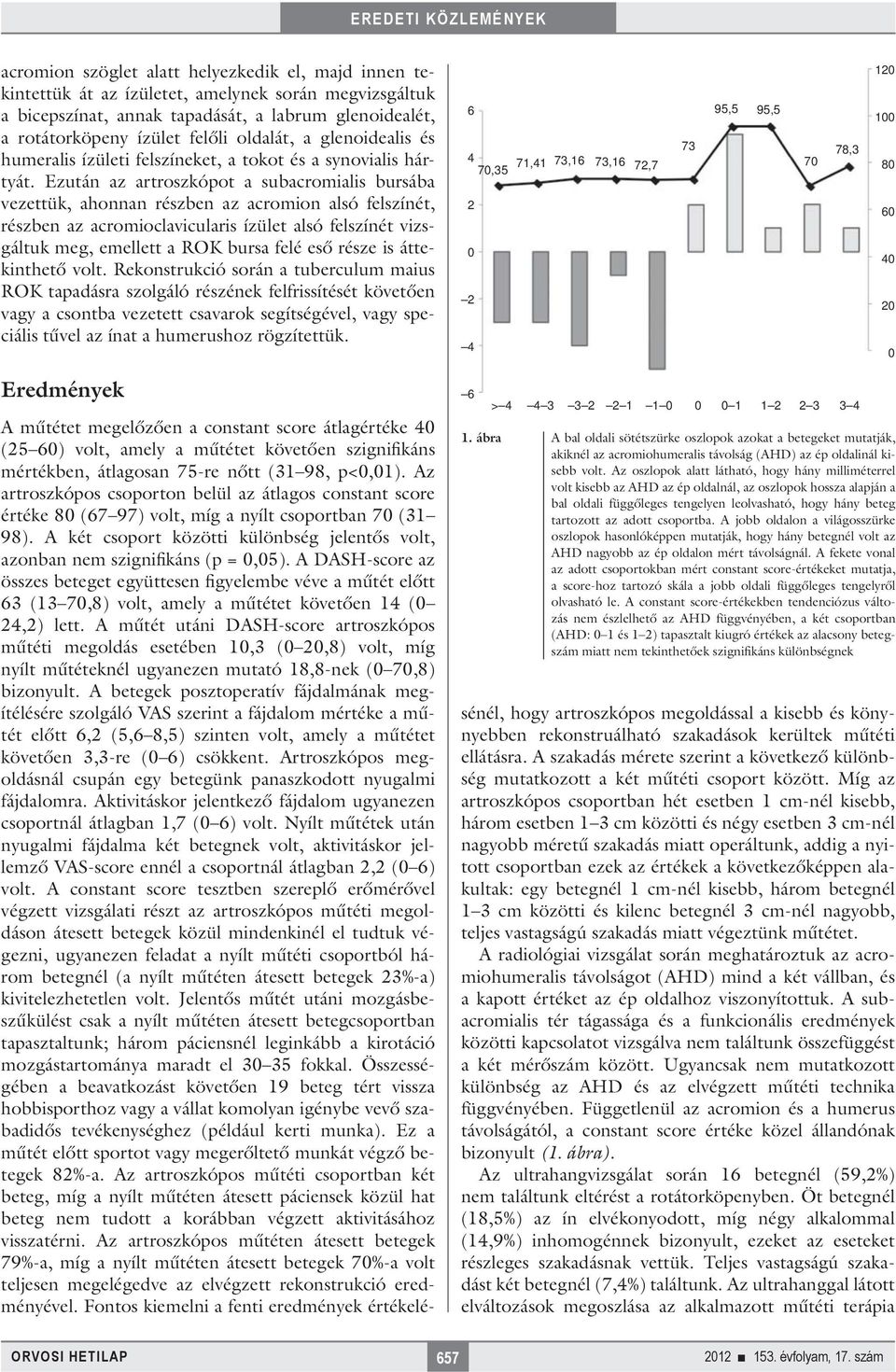 Ezután az artroszkópot a subacromialis bursába vezettük, ahonnan részben az acromion alsó felszínét, részben az acromioclavicularis ízület alsó felszínét vizsgáltuk meg, emellett a ROK bursa felé eső