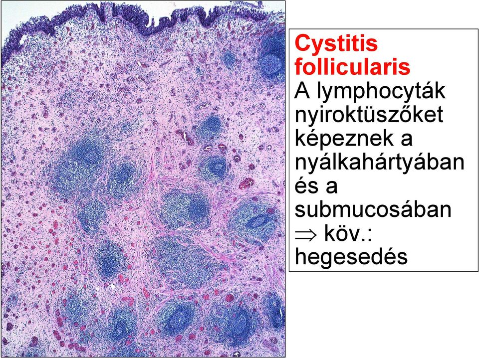 képeznek a nyálkahártyában