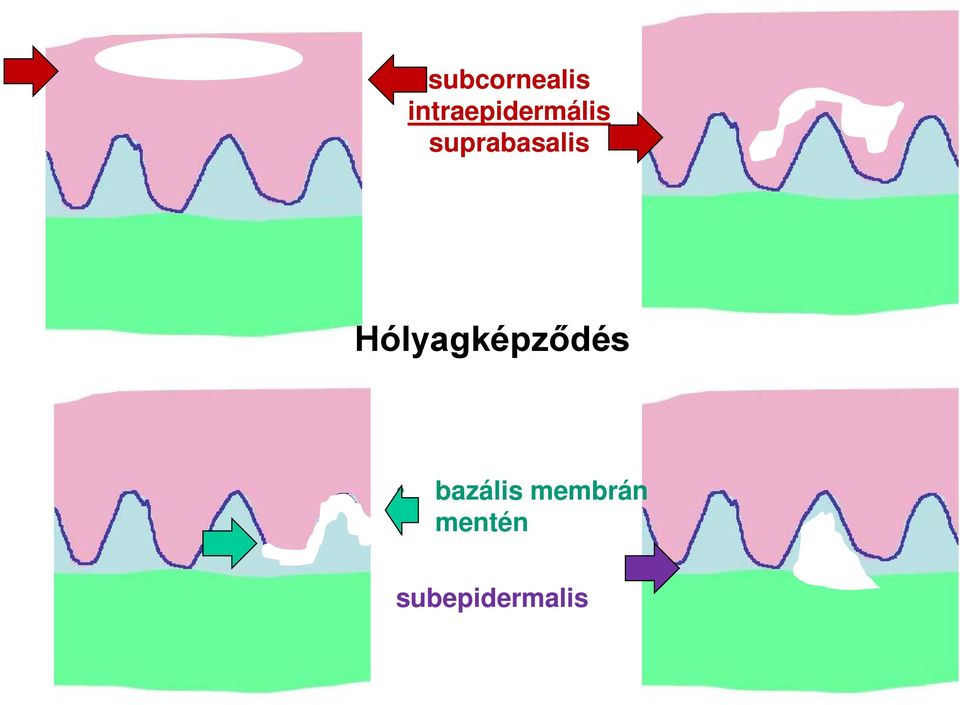 suprabasalis
