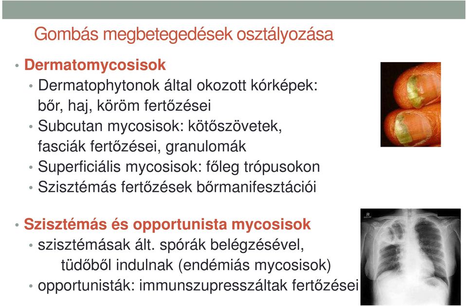 főleg trópusokon Szisztémás fertőzések bőrmanifesztációi Szisztémás és opportunista mycosisok szisztémásak