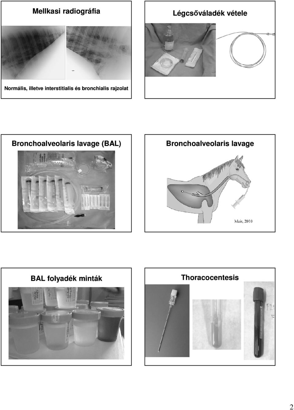 bronchialis rajzolat Bronchoalveolaris lavage