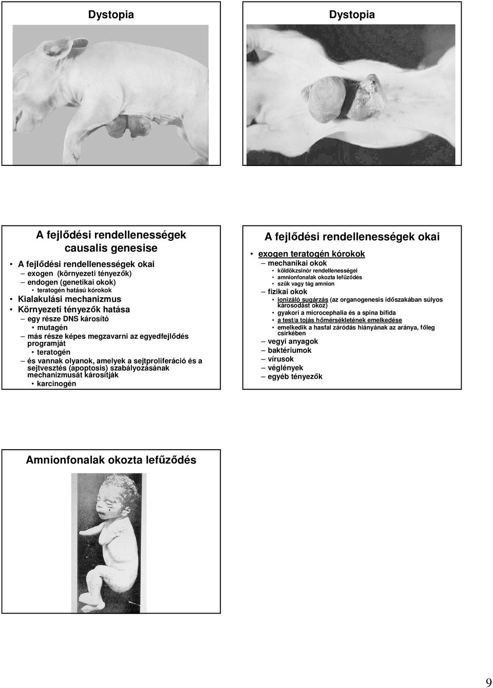 (apoptosis) szabályozásának mechanizmusát károsítják karcinogén A fejlıdési rendellenességek okai exogen teratogén kórokok mechanikai okok köldökzsinór rendellenességei amnionfonalak okozta lefőzıdés