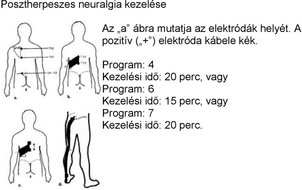 Program: 4 Kezelési idő: 20 perc, vagy Program: 6