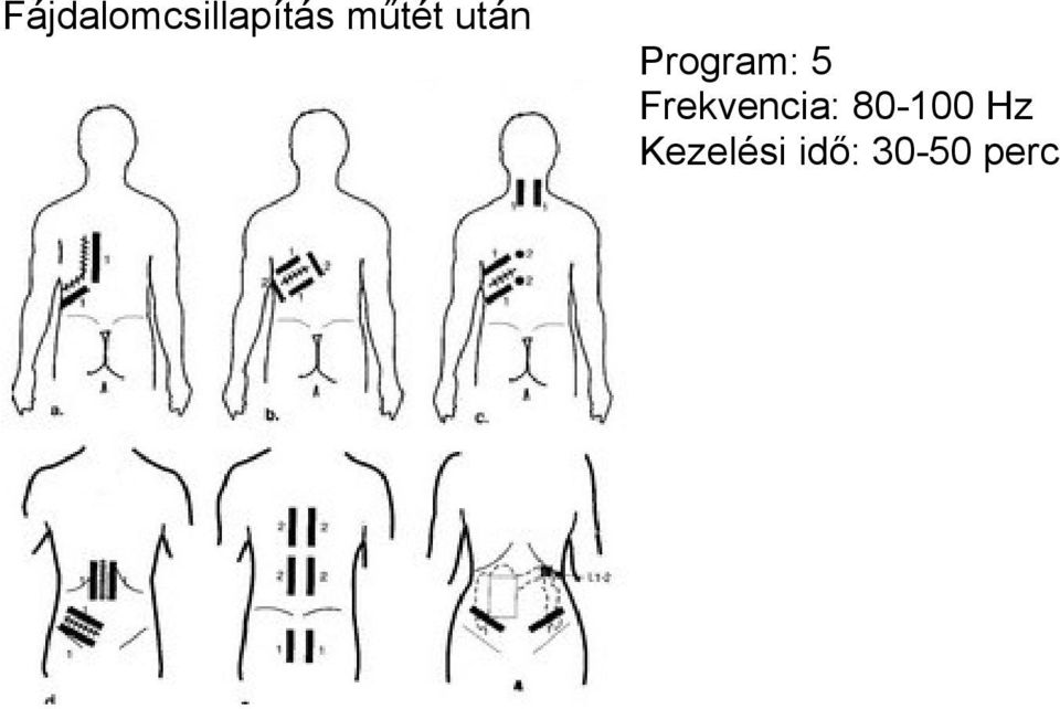 Frekvencia: 80-100 Hz