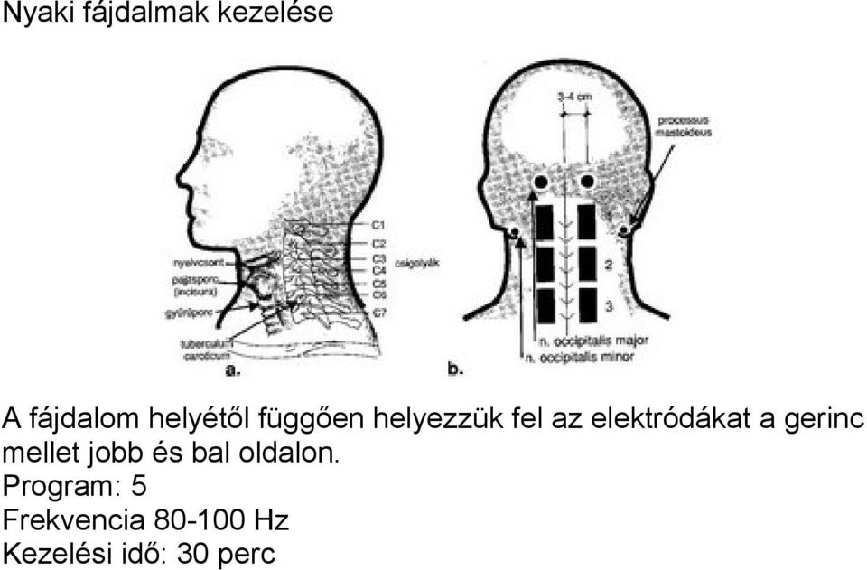 elektródákat a gerinc mellet jobb és bal