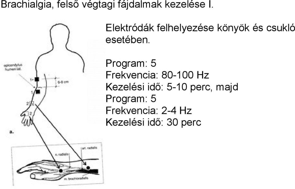 Program: 5 Frekvencia: 80-100 Hz Kezelési idő: 5-10