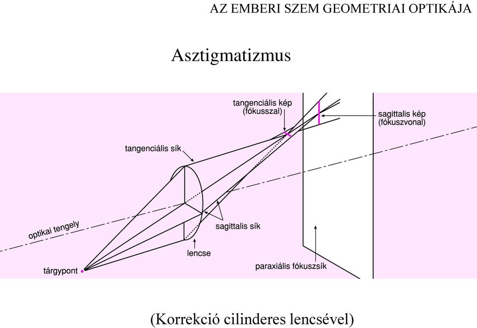 Asztigmatizmus