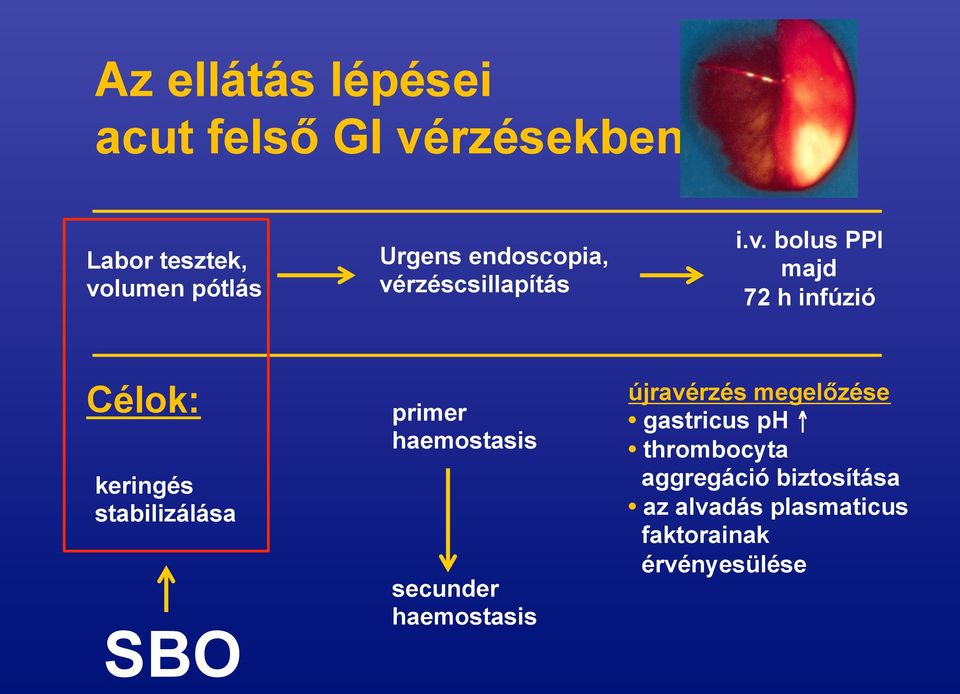 rzéscsillapítás i.v.