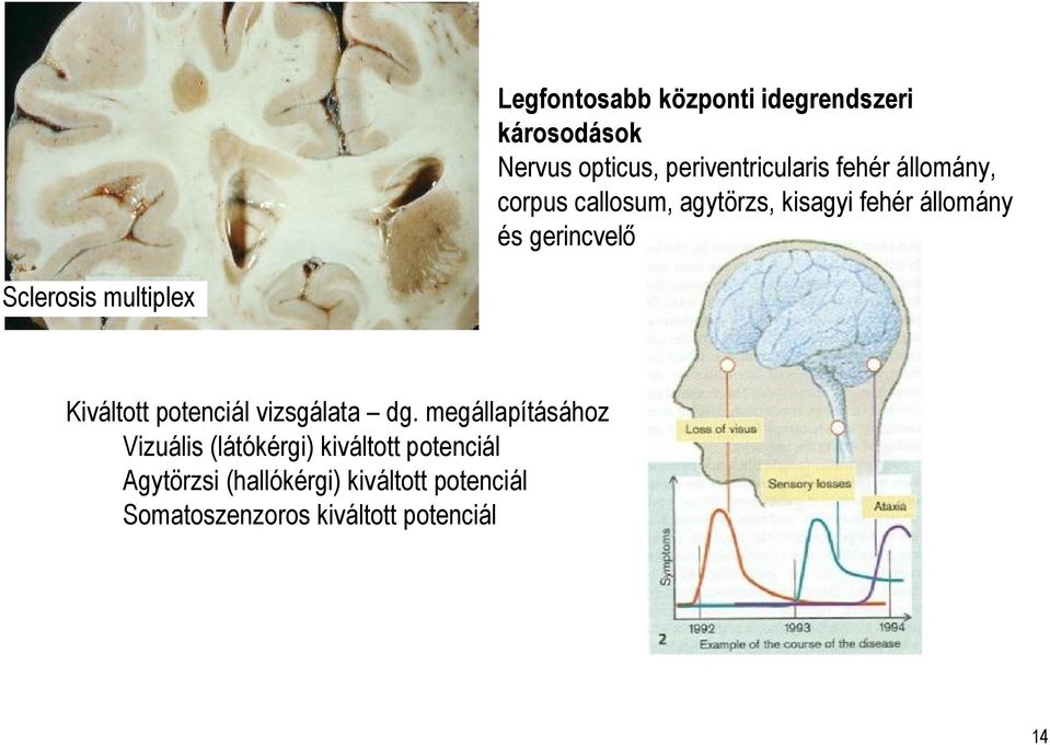 multiplex Kiváltott potenciál vizsgálata dg.