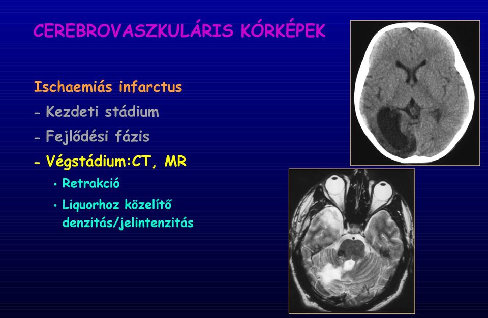 Fejlődési fázis Végstádium:CT, MR