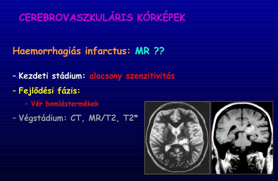 ? Kezdeti stádium: alacsony