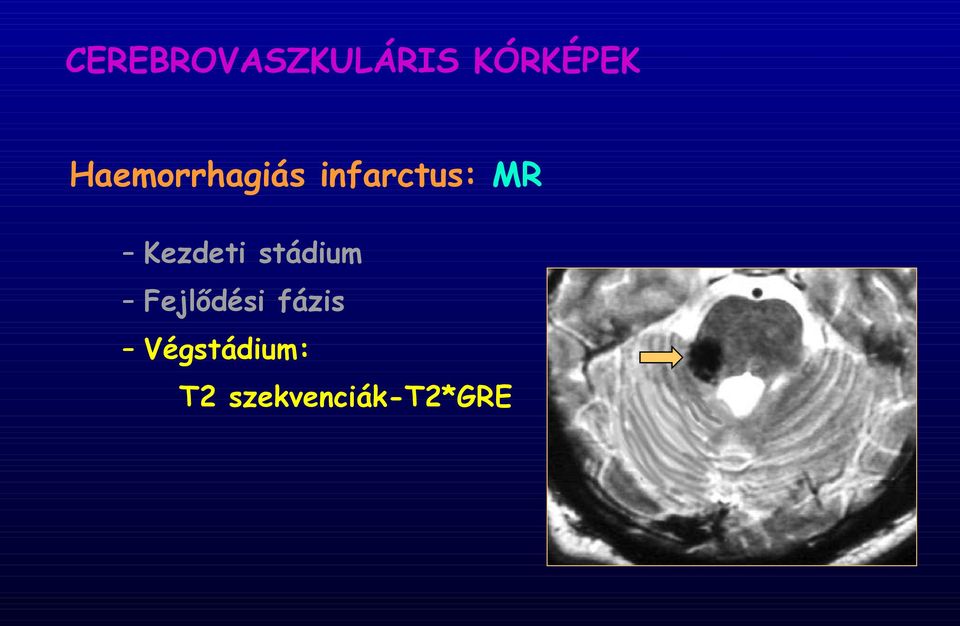 Kezdeti stádium Fejlődési