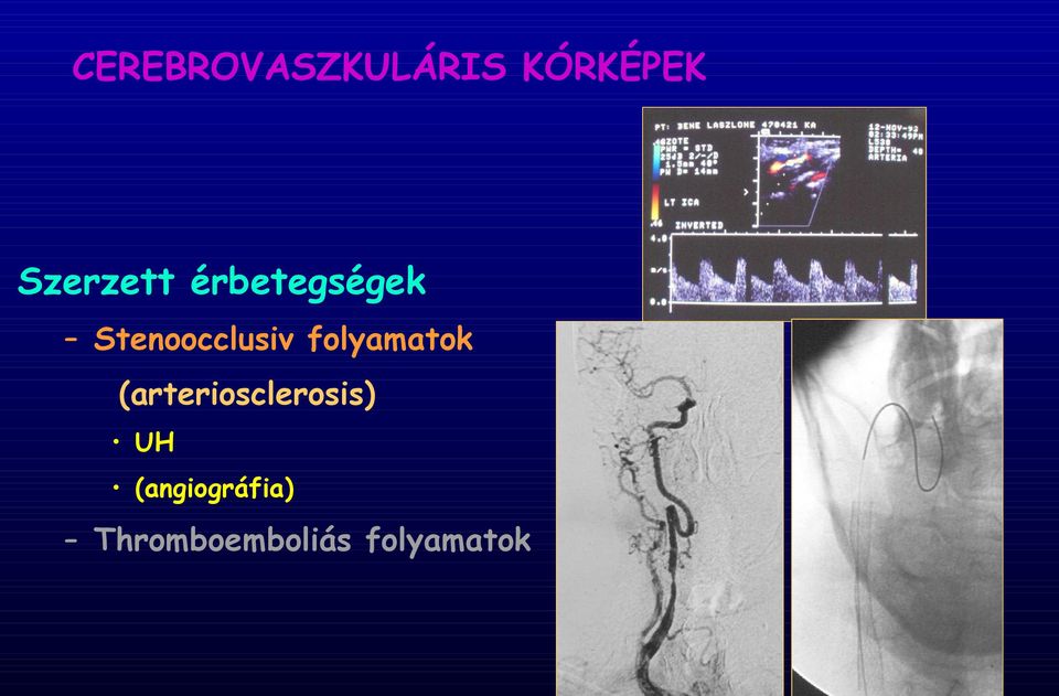 Stenoocclusiv folyamatok