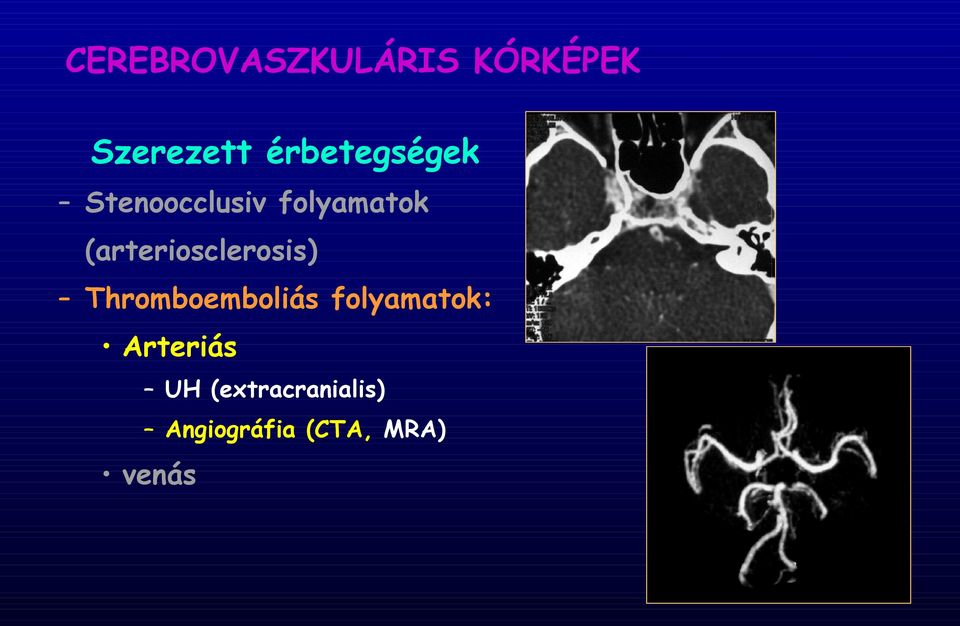 (arteriosclerosis) Thromboemboliás