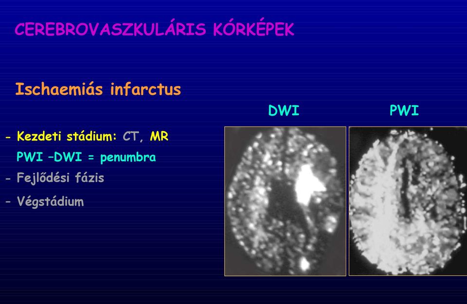 Kezdeti stádium: CT, MR PWI DWI