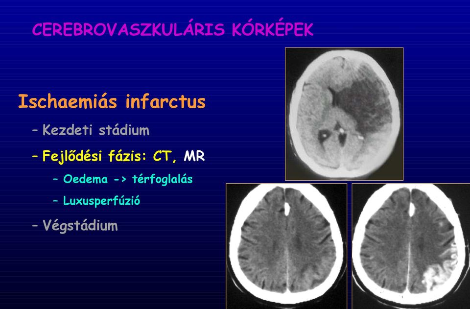 stádium Fejlődési fázis: CT, MR