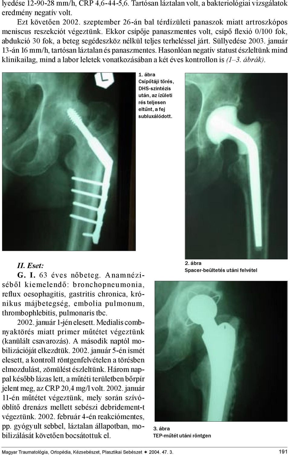 Ekkor csípője panaszmentes volt, csípő flexió 0/100 fok, abdukció 30 fok, a beteg segédeszköz nélkül teljes terheléssel járt. Süllyedése 2003. január 13-án 16 mm/h, tartósan láztalan és panaszmentes.