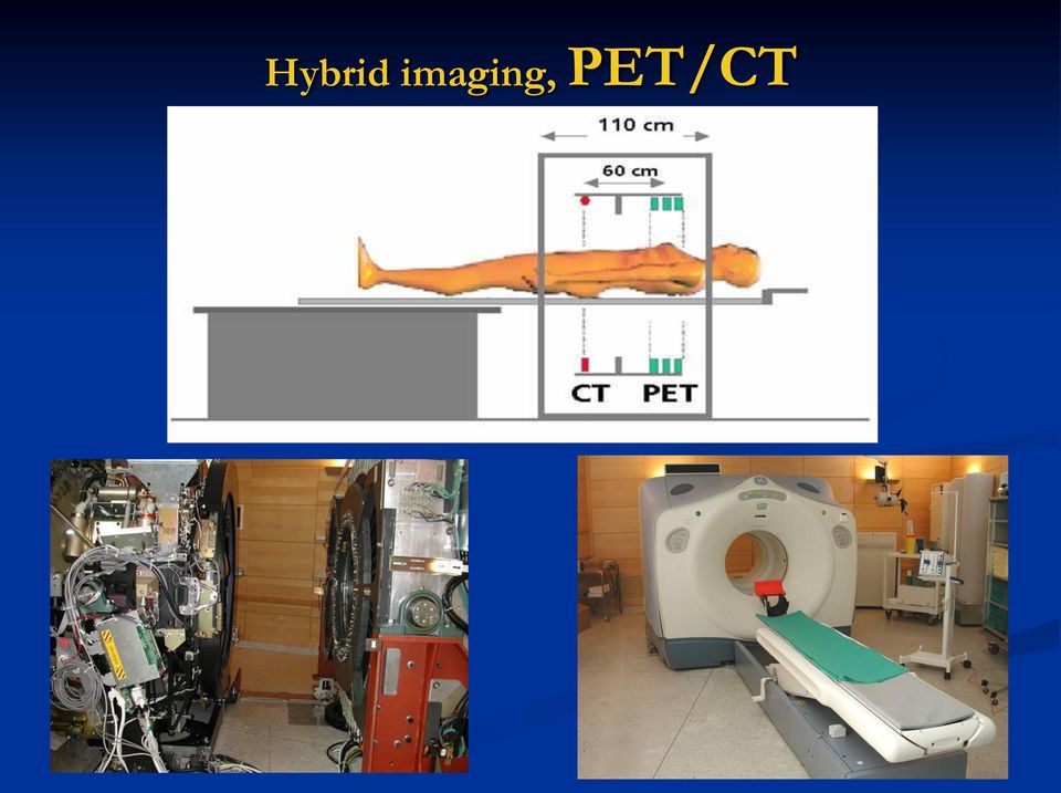 PET/CT