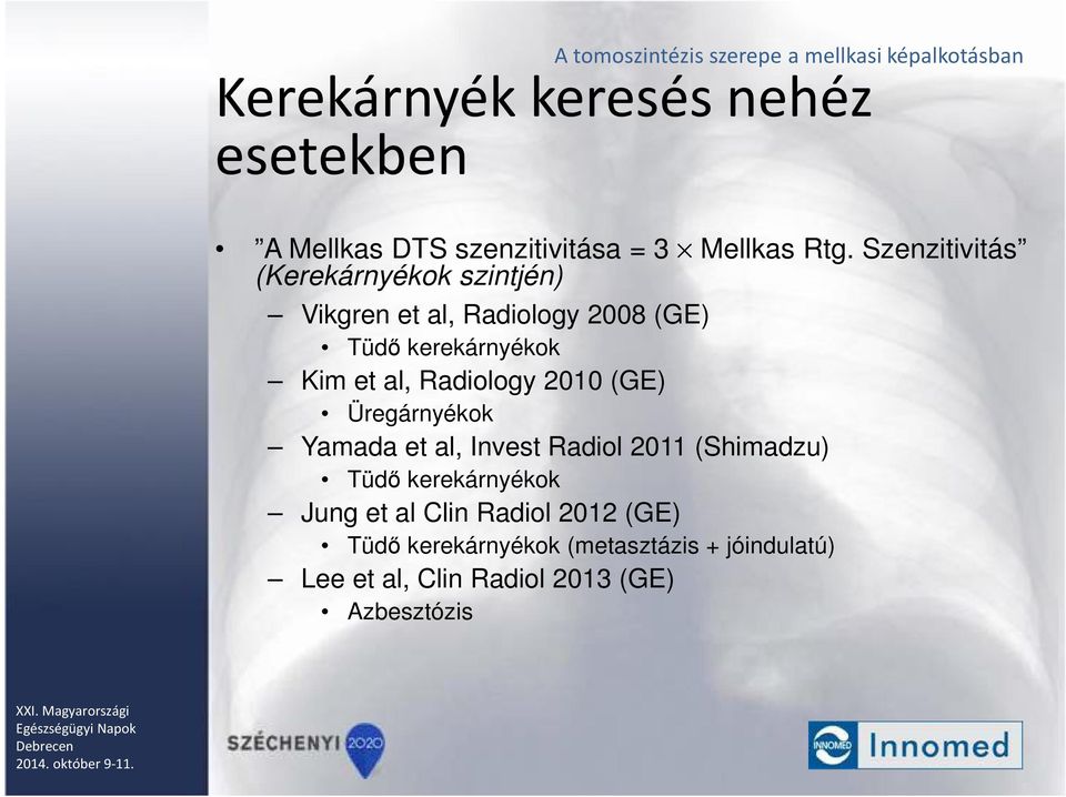 al, Radiology 2010 (GE) Üregárnyékok Yamada et al, Invest Radiol 2011 (Shimadzu) Tüdő kerekárnyékok