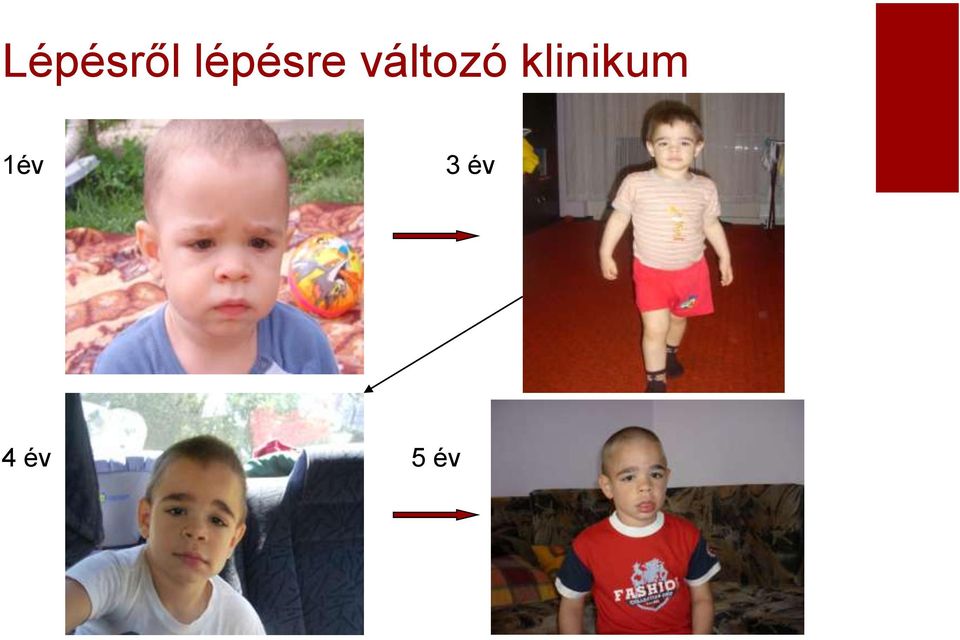 változó