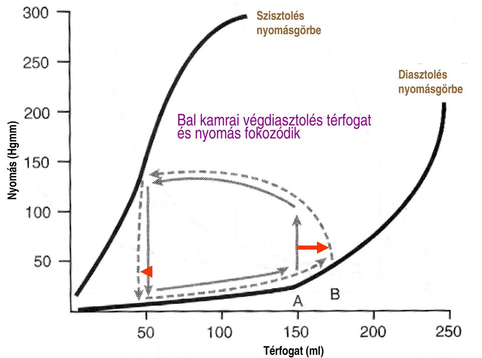 (Hgmm) Bal kamrai végdiasztolés