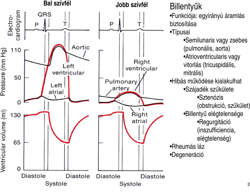(tricuspidális, mitrális) Hibás működése kialakulhat Szájadék szűkülete Sztenózis