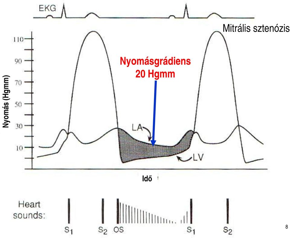 Nyomás (Hgmm)